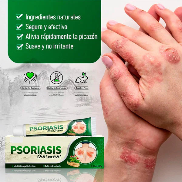 Crema Antifúngica y Antipicazón Jinyue – Tratamiento Natural para Tiña, Hongos y Psoriasis | 20g