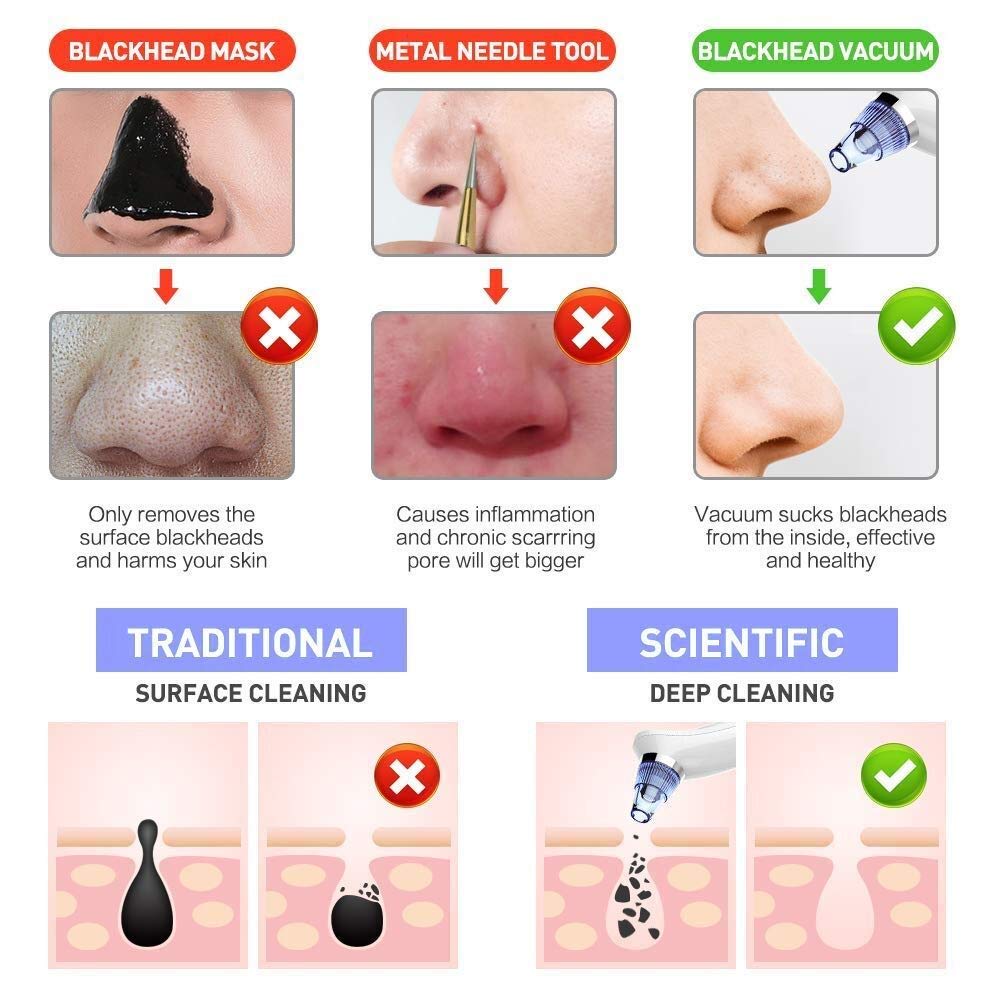 Removedor De Espinillas Al vacío Limpiador