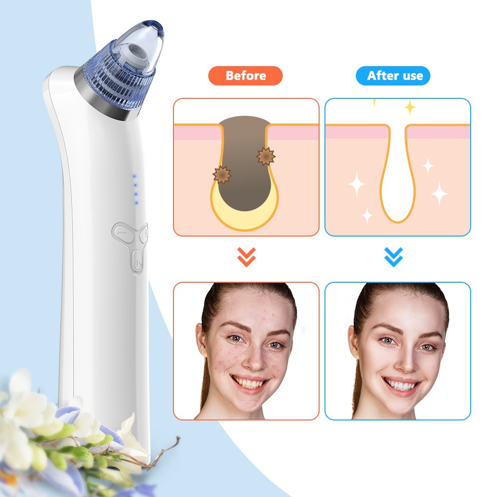 Removedor De Espinillas Al vacío Limpiador