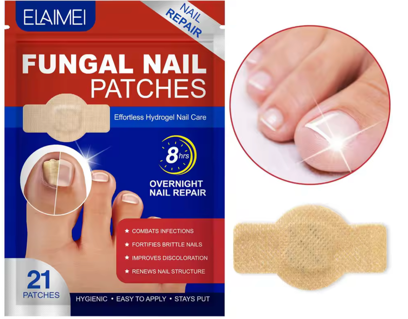 NailLift™ - Parches para Uñas Encarnadas